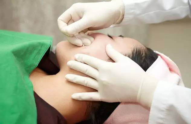 祛皺逆齡，黃金線(xiàn)雕的回春優(yōu)勢(shì)